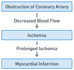 Mechanism of Myocardial Infarction